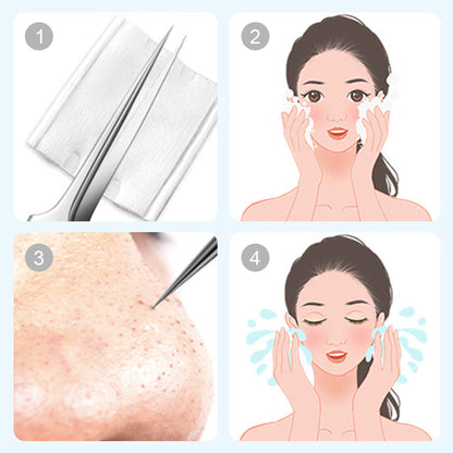 💓2026 HOT SALE 50% OFF💥Medical Grade Blackhead Extraction Tool Kit