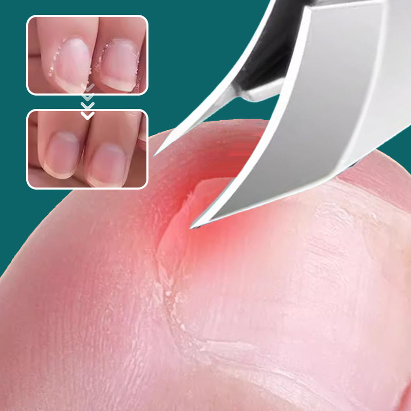 💅 50% OFF NOW! ✨ Anti-Splash 25° Slant Edge Nail Clipper 3-Piece Set – Precise Cut, Comfortable Grip & Safe Splash Guard ✂️