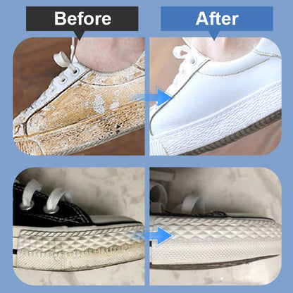 ⏰🔥LIMITED TIME 50% OFF! 👟 Portable Shoe Stain Remover Kit – 50K+ Sold, Easy & Quick Cleaning Anywhere ✨💦