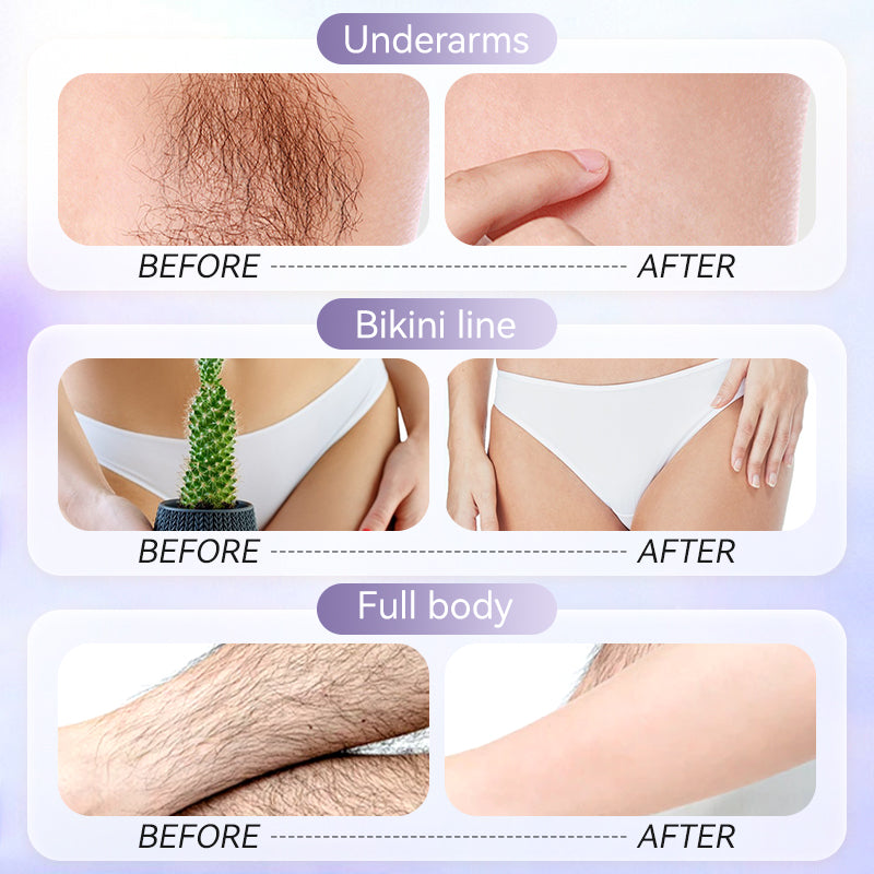 🥳2026 HOT SALE🥳💞50K+ SOLD!💚🌸 Gentle Hair Removal, Zero Discomfort! Natural Cream for Smooth Skin – 50% OFF! ✨🌿